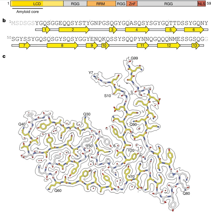 Nature：科学家识别出与人类额颞叶痴呆症发生相关的新型蛋白质